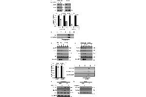 Western Blotting (WB) image for anti-COL1A2/COL1A1 antibody (ABIN5596819)