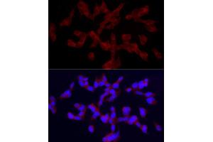 Immunofluorescence analysis of SH-SY5Y cells using TRPC5 Rabbit pAb (ABIN6128835, ABIN6149578, ABIN6149579 and ABIN6214219) at dilution of 1:150 (40x lens). (TRPC5 antibody  (AA 764-973))