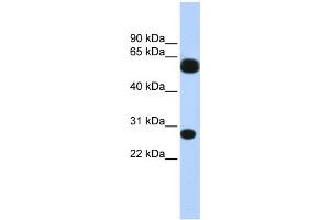 WB Suggested Anti-TRIM16 Antibody Titration:  0.