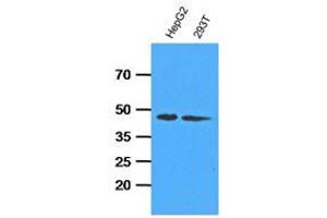 Western Blotting (WB) image for anti-Adenosine Kinase (ADK) antibody (ABIN781539) (ADK antibody)