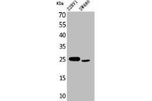 Western Blot analysis of 22RV-1 SW480 cells using SSX Polyclonal Antibody (SSX1 antibody  (C-Term))