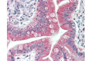 Anti-MAP1LC3C / LC3C antibody IHC staining of human small intestine. (LC3C antibody  (Thr48))