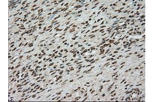 Immunohistochemical staining of paraffin-embedded colon tissue using anti-TYRO3mouse monoclonal antibody. (TYRO3 antibody)