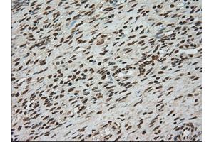 Immunohistochemical staining of paraffin-embedded colon tissue using anti-TYRO3mouse monoclonal antibody.