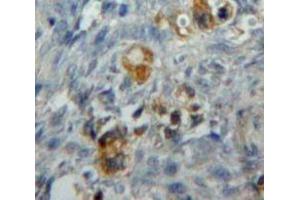 IHC-P analysis of Ovary tissue, with DAB staining. (CD276 antibody  (AA 47-213))