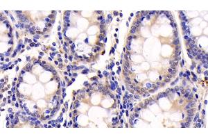 Detection of IGF1 in Human Colon Tissue using Monoclonal Antibody to Insulin Like Growth Factor 1 (IGF1)