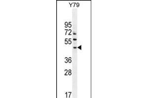 LACE1 Antibody (N-term) (ABIN654572 and ABIN2844276) western blot analysis in Y79 cell line lysates (35 μg/lane).