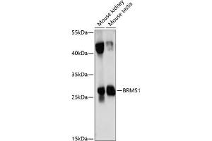 Western blot analysis of extracts of various cell lines, using BRMS1 antibody (ABIN7265929) at 1:1000 dilution. (BRMS1 antibody  (AA 90-210))