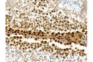 Phospho-HBP1 (Ser402) Antibody at 1/100 staining Rat testis tissue by IHC-P.