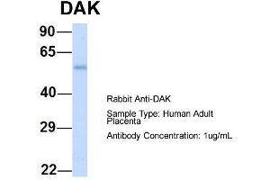 Host: Rabbit  Target Name: DAK  Sample Tissue: Human Adult Placenta  Antibody Dilution: 1.