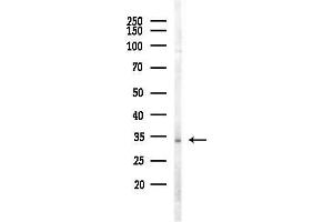 Western blot analysis of lysates from MDA-MB-231 cells(heat-shock,45 min treatment), using AIMP1 Antibody at 1/1000 dilution.