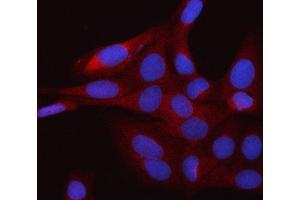 IF analysis of RAP1GDS1 using anti-RAP1GDS1 antibody (ABIN7601725). (RAP1GDS1 antibody  (AA 43-607))