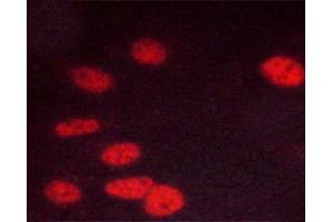 ABIN6267447 staining C6 cells by ICC/IF. (CDK1 antibody  (pThr14))