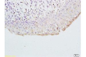 Formalin-fixed and paraffin embedded dog bladder tissue labeled with Anti- CXCL13/BCA1 Polyclonal Antibody, Unconjugated  at 1:200 followed by conjugation to the secondary antibody and DAB (CXCL13 antibody  (AA 23-109))