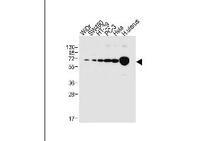 All lanes : Anti-NOX1 Antibody (Center) at 1:1000 dilution Lane 1: WiDr whole cell lysate Lane 2: S whole cell lysate Lane 3: HT-29 whole cell lysate Lane 4: PC-3 whole cell lysate Lane 5: Hela whole cell lysate Lane 6: human uterus tissue lysate Lysates/proteins at 20 μg per lane. (NOX1 antibody  (AA 243-271))