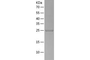 Western Blotting (WB) image for Ubiquitin Specific Peptidase 33 (USP33) (AA 71-303) protein (His tag) (ABIN7288040) (USP33 Protein (AA 71-303) (His tag))