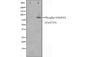 Western blot analysis of VEGFR1 phosphorylation expression in UV treated HeLa whole cell lysates,The lane on the left is treated with the antigen-specific peptide. (FLT1 antibody  (pTyr1213))
