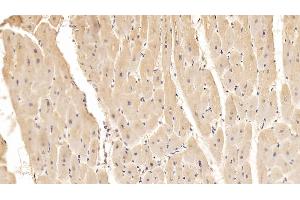 Detection of ADPN in Porcine Cardiac Muscle Tissue using Monoclonal Antibody to Adiponectin (ADPN) (ADIPOQ antibody  (AA 18-243))