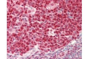 Human Tonsil: Formalin-Fixed, Paraffin-Embedded (FFPE) (TCEA1 antibody  (AA 200-250))