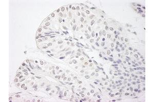 Immunohistochemistry (IHC) image for anti-Lysine (K)-Specific Demethylase 5A (KDM5A) (AA 1640-1690) antibody (ABIN7448612)
