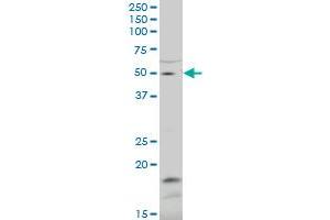 ZNF83 polyclonal antibody (A01), Lot # 051115JC01. (ZNF83 antibody  (AA 1-111))