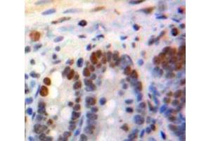 IHC-P analysis of Bowels tissue, with DAB staining. (KLF4 antibody  (AA 240-478))