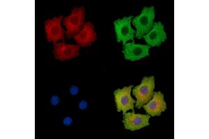 ABIN7095914 and ABIN7099976 staining HepG2 cells by IF/ICC. (CCSER1 antibody)