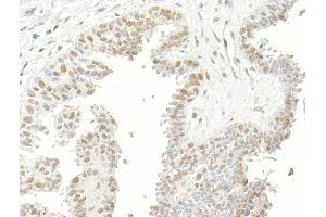 Immunohistochemistry (IHC) image for anti-Ubiquitin Specific Peptidase 7 (Herpes Virus-Associated) (USP7) (AA 1-50) antibody (ABIN7453547) (USP7 antibody  (AA 1-50))