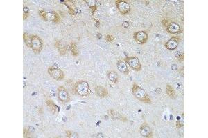 Immunohistochemistry of paraffin-embedded Mouse brain using TMOD3 Polyclonal Antibody at dilution of 1:100 (40x lens). (TMOD3 antibody)
