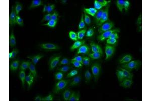 Immunofluorescence staining of HepG2 cells with ABIN7170215 at 1:66, counter-stained with DAPI. (Slc26a9 antibody  (AA 551-660))