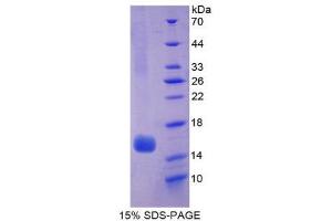 SDS-PAGE (SDS) image for Hexosaminidase B (Beta Polypeptide) (HEXB) (AA 315-456) protein (His tag) (ABIN1525446)