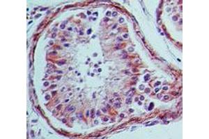 Immunohistochemistry of mouse Anti-TLR4 antibody. (TLR4 antibody)