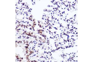 Immunohistochemistry of paraffin-embedded mouse lung using USP39 Rabbit mAb (ABIN7271160) at dilution of 1:100 (40x lens). (USP39 antibody)