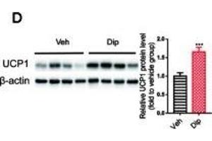 Diphyllin enhances brown/beige thermogenesis and reduces adipocyte size in DIO mice. (UCP1 antibody  (AA 1-307))