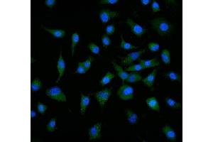 IF analysis of Neuropilin 1 using anti-Neuropilin 1 antibody (ABIN7601920).