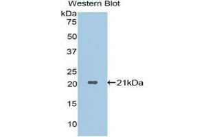 Western Blotting (WB) image for anti-Proteinase 3 (PRTN3) (AA 71-247) antibody (ABIN1860295) (PRTN3 antibody  (AA 71-247))