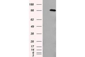 HEK293T cells were transfected with the pCMV6-ENTRY control (Left lane) or pCMV6-ENTRY APP (Right lane) cDNA for 48 hrs and lysed. (APP antibody)