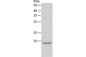 Western Blotting (WB) image for Synaptonemal Complex Central Element Protein 3 (SYCE3) (AA 1-88) protein (His tag) (ABIN7125268) (SYCE3 Protein (AA 1-88) (His tag))