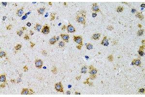 Immunohistochemistry of paraffin-embedded Rat brain using PDYN Polyclonal Antibody at dilution of 1:100 (40x lens).