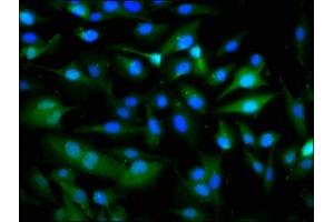 Immunofluorescence staining of U251 cells with ABIN7162583 at 1:266, counter-stained with DAPI. (PANX1 antibody  (AA 288-426))