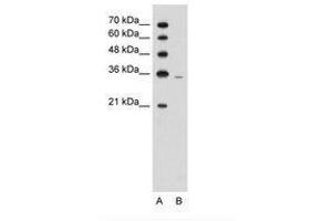 Image no. 1 for anti-phosphoribosyl Pyrophosphate Synthetase 2 (PRPS2) (AA 157-206) antibody (ABIN203392) (PRPS2 antibody  (AA 157-206))