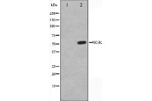 Western blot analysis of SGK expression in Jurkat whole cell lysates,The lane on the left is treated with the antigen-specific peptide. (SGK1 antibody  (C-Term))
