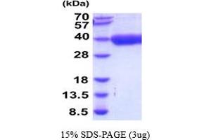 SDS-PAGE (SDS) image for Cathepsin Z (CTSZ) (AA 23-306) protein (His tag) (ABIN5854507)