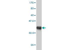 Western Blot detection against Immunogen (37. (RAB21 antibody  (AA 116-225))