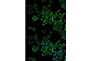 Immunofluorescence (IF) image for anti-Fission 1 (FIS1) (AA 1-122) antibody (ABIN6140642)