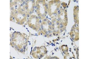 Immunohistochemistry of paraffin-embedded Human stomach using MRPS22 Polyclonal Antibody at dilution of 1:100 (40x lens). (MRPS22 antibody)