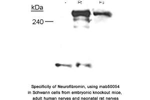 Image no. 1 for anti-Neurofibromin 1 (NF1) (N-Term) antibody (ABIN363208) (Neurofibromin 1 antibody  (N-Term))