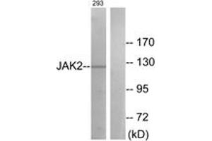 Western blot analysis of extracts from 293 cells, treated with etoposide 25uM 24h, using JAK2 (Ab-570) Antibody. (JAK2 antibody  (AA 541-590))