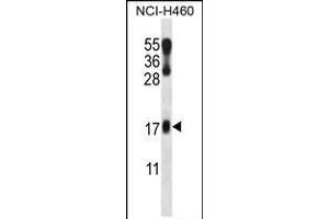 LMO2 Antibody (N-term) (ABIN658023 and ABIN2846961) western blot analysis in NCI- cell line lysates (35 μg/lane).