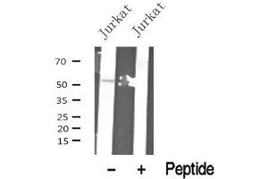 Western blot analysis of Smad1/9 in lysates of Jurkat? (Smad1/9 antibody)